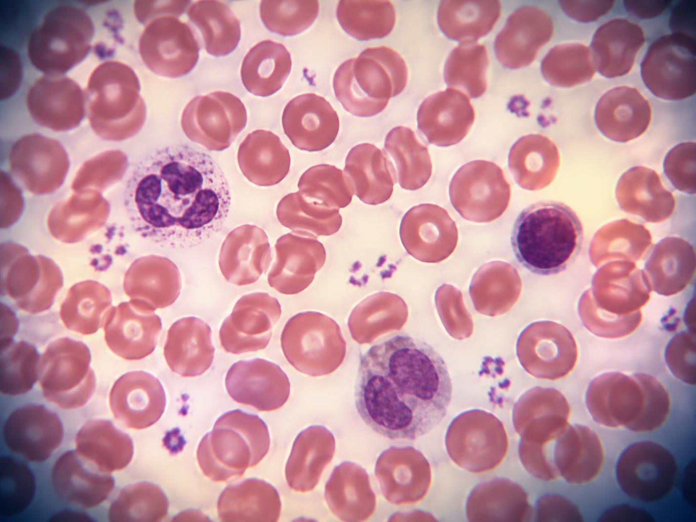 Blood smear under the microscope